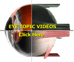 video-eyetopic