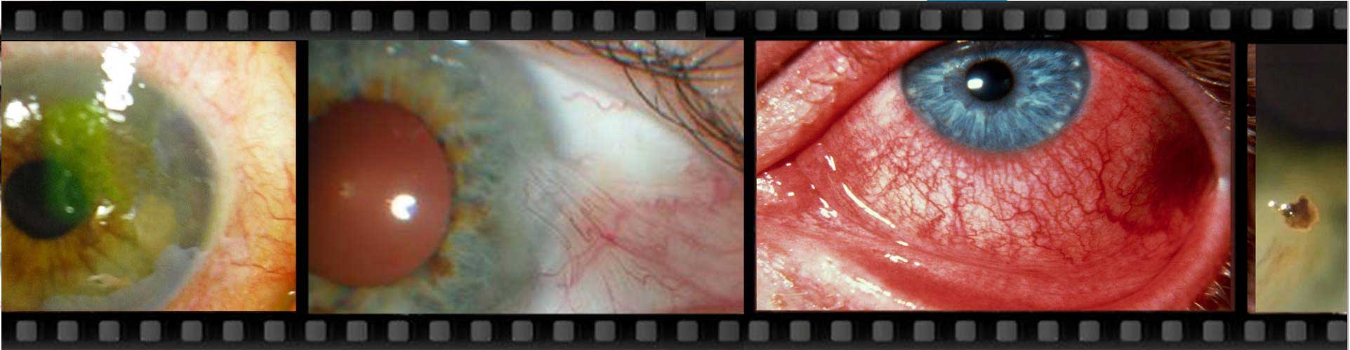 Eye Emergencies The Spectrum Eye Centre